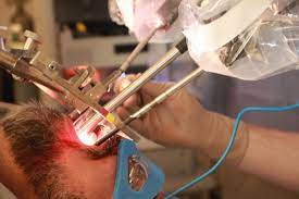 head and neck cancer treatment in Muzaffarnagar