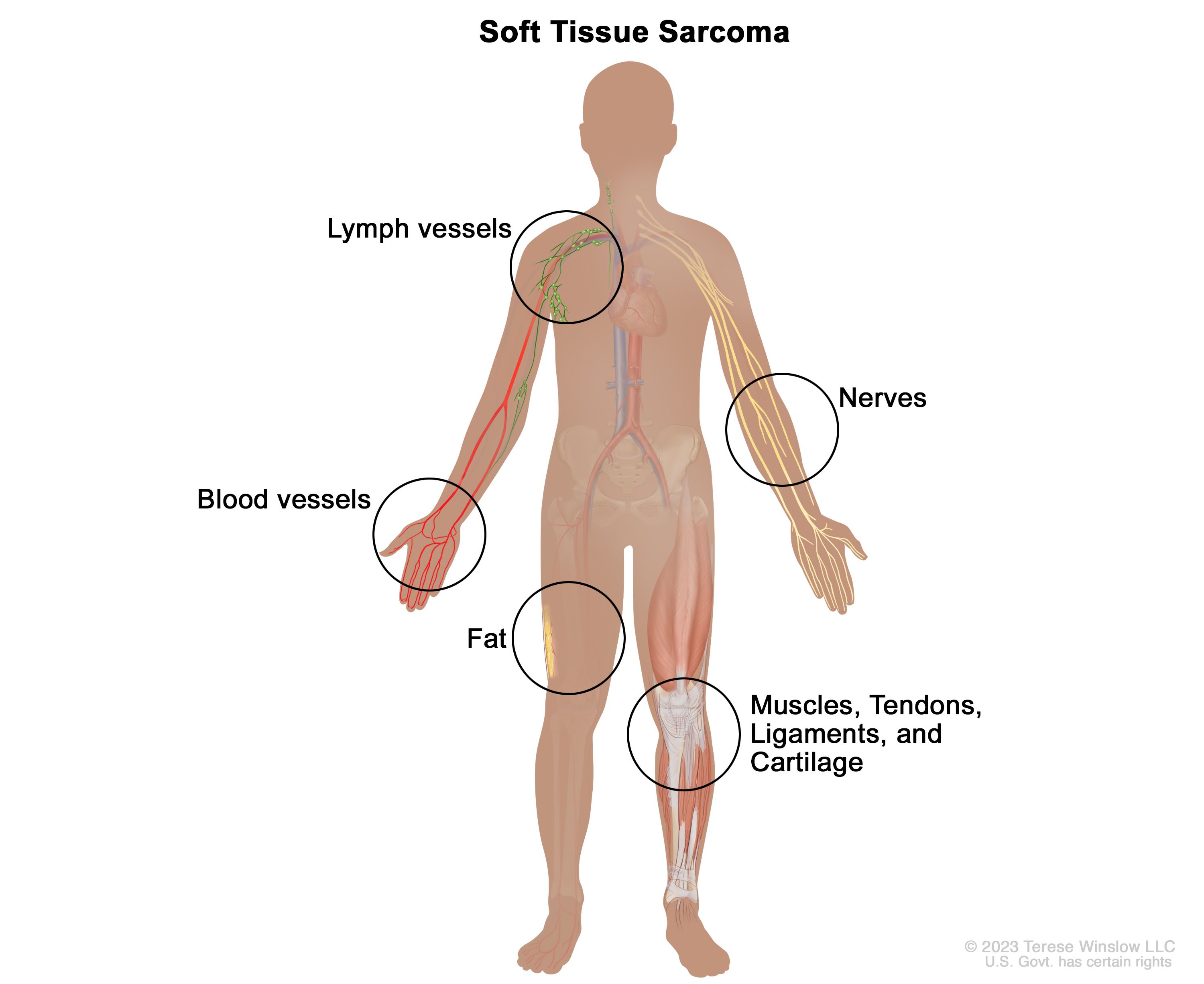 Doctors For Soft Tissue Sarcoma Cancer In Rohtak