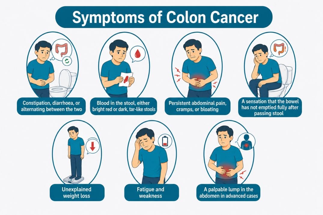 Colon Cancer treatment in delhi NCR. Best doctor for colon cancer treatment in delhi